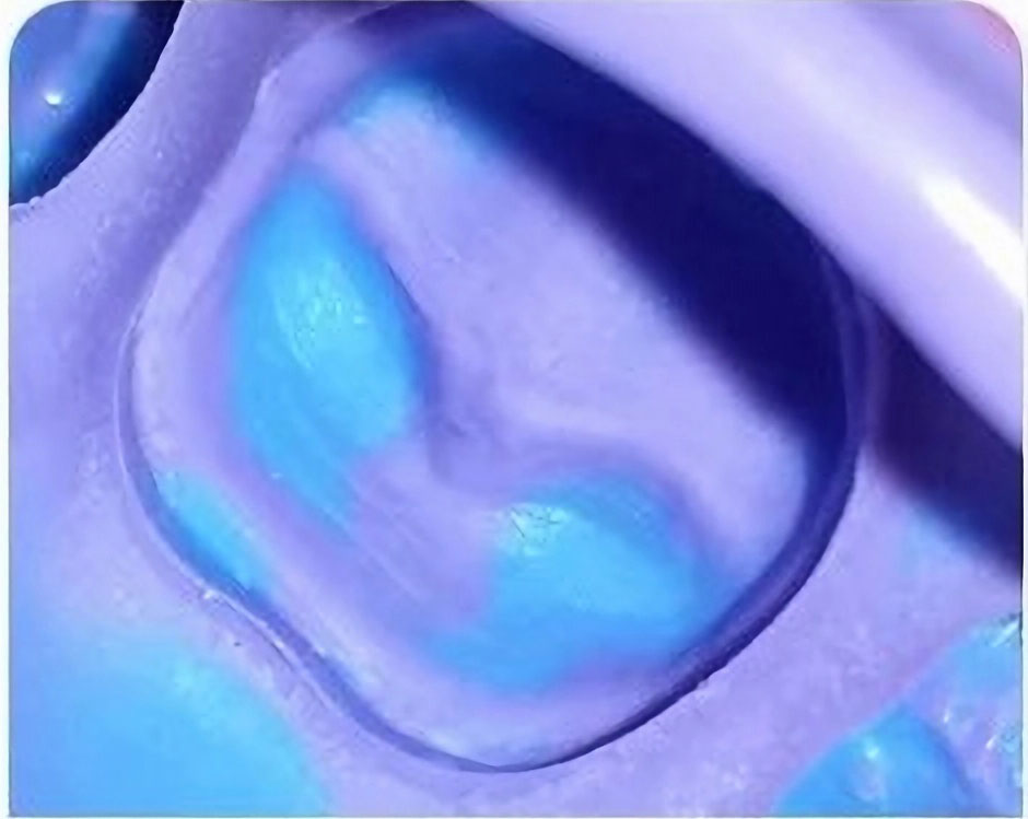 Dental Impression Material with Excellent Stability
