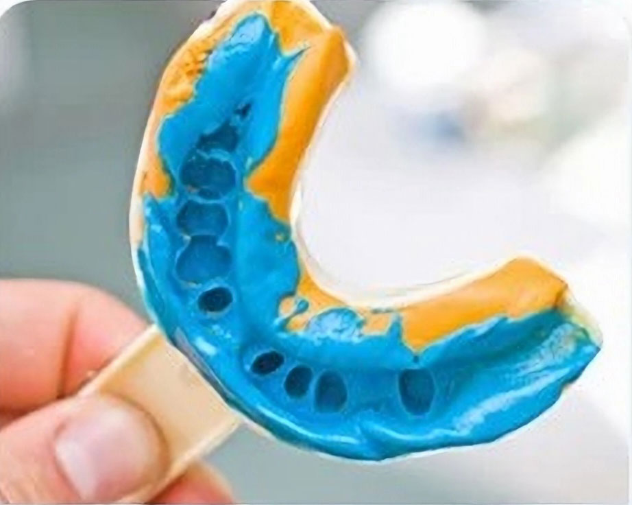 Dental Impression Material Suitable for Long Term Storage