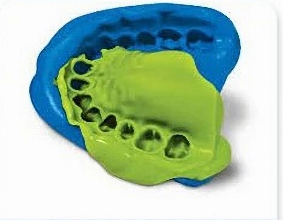 Dental Impression Material with Best Recovery
