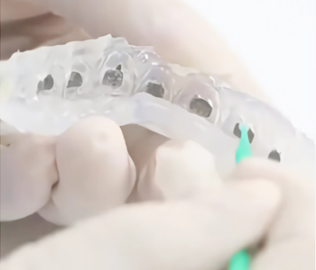 Preparation of Dental Transfer Trays