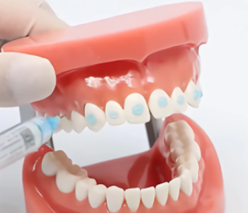 Preparation of Dental Transfer Trays