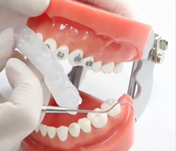 Preparation of Dental Transfer Trays