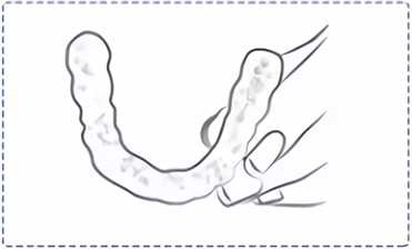 Spread foam evenly on retainer