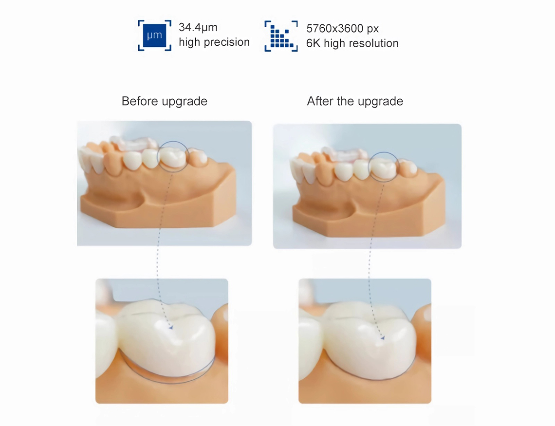 3D printed dental model with high accuracy