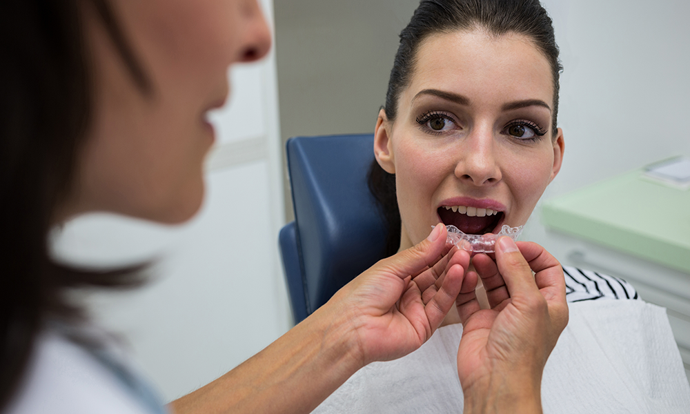 Clear Aligner Treatment