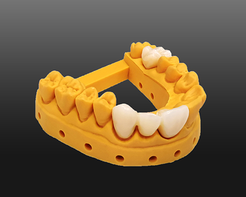 Aesthetic Temporary Crown Resin with Natural Shades